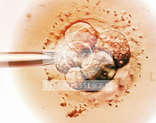 做试管婴儿，如何提高胚胎移植的成功率？
