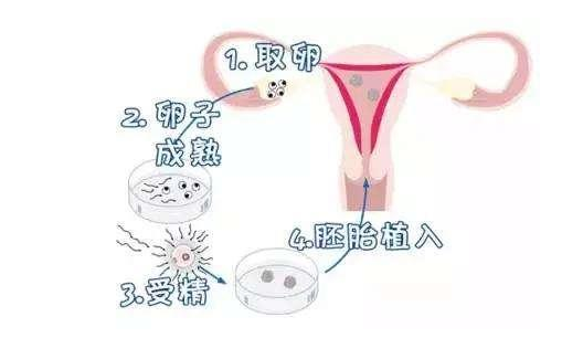 泰国试管婴儿促排卵、降调